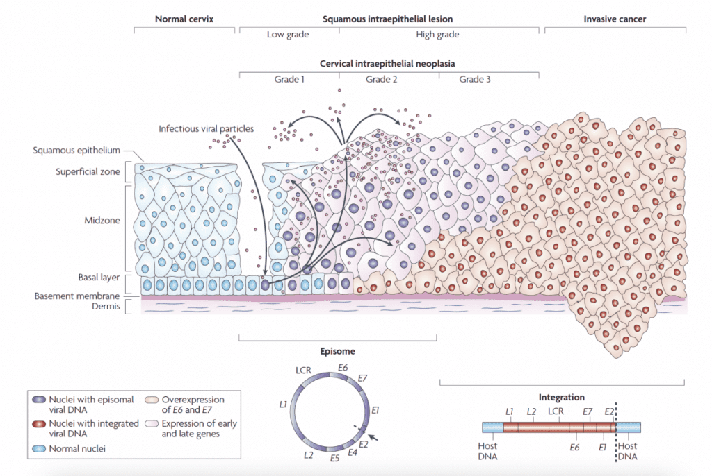 De infección a cáncer
