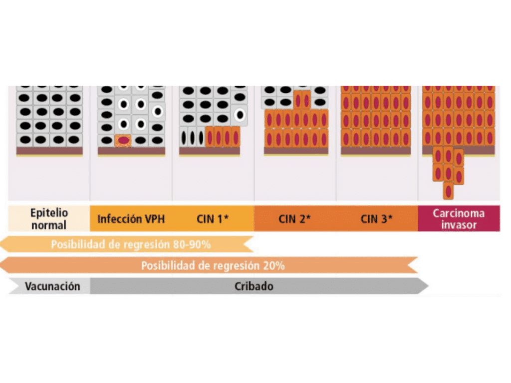 Geles vaginales, genitales, anales, para VPH.