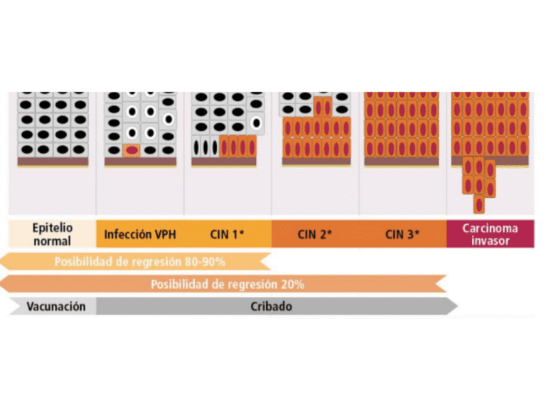Geles vaginales, genitales, anales, para VPH.