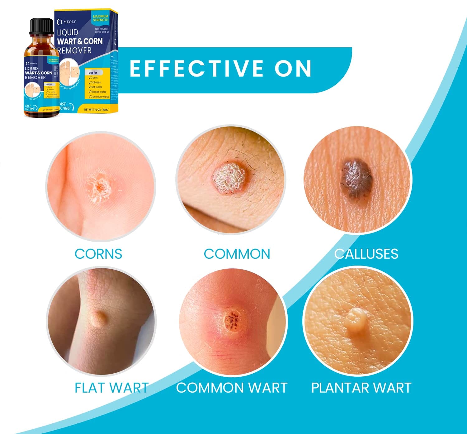 MEOLY, aceite salicílico verrugas, 15 ml - Imagen 2