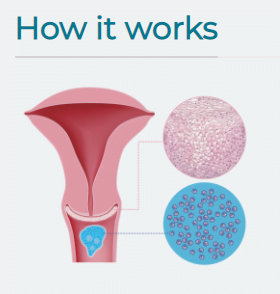 DEFLAGYN Gel Vaginal 150 ml - Imagen 4