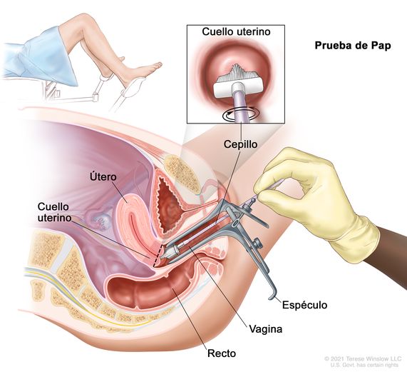 Prueba VPH /Pap