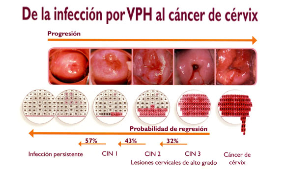 Fases cáncer cervix