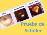 Prueba de Schiller