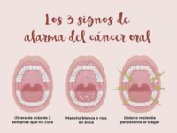 Cáncer oral signos