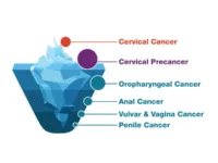 Tipos cáncer VPH