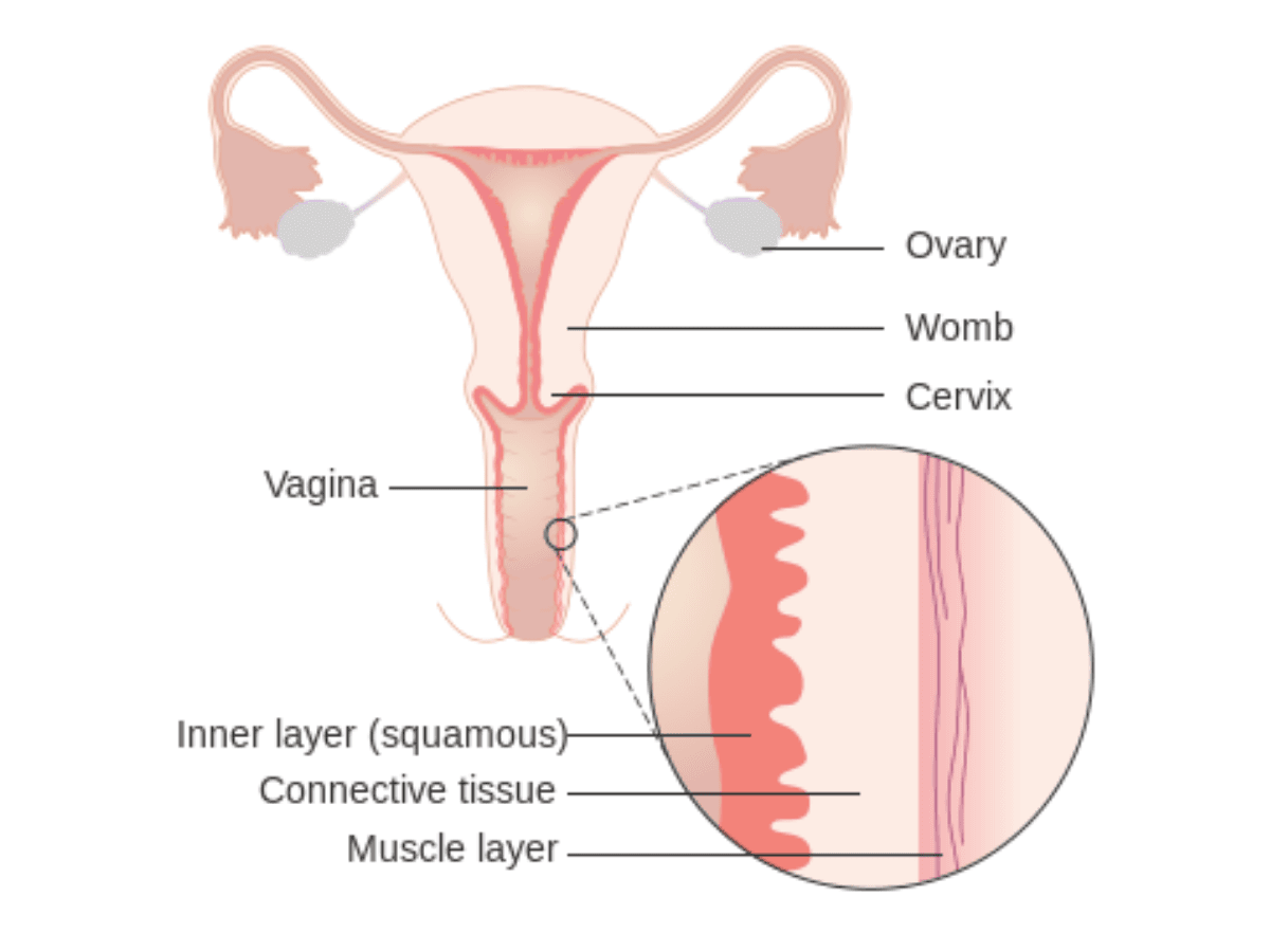 Conización preguntas