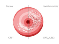 Pruebas detección VPH