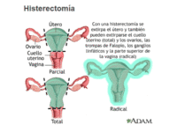 Resultado positivo VPH