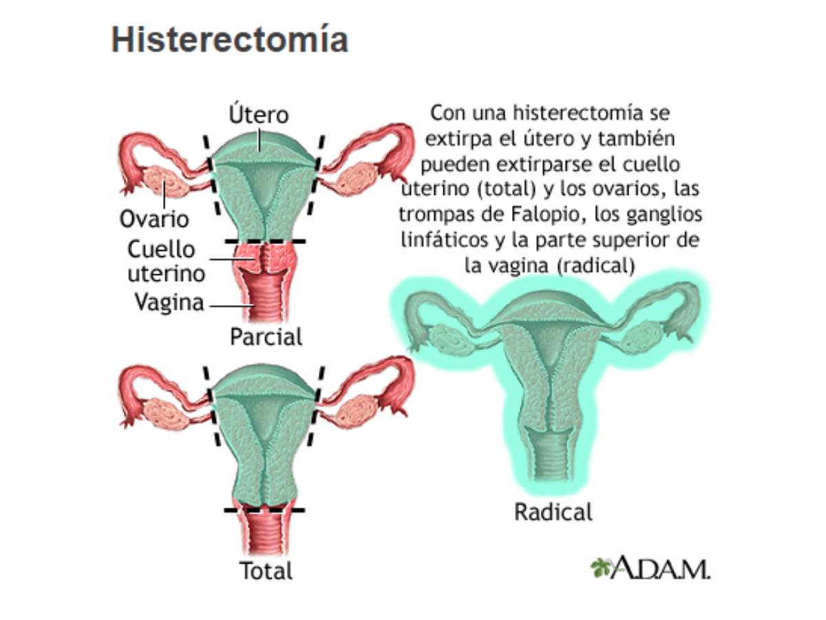 Resultado positivo VPH
