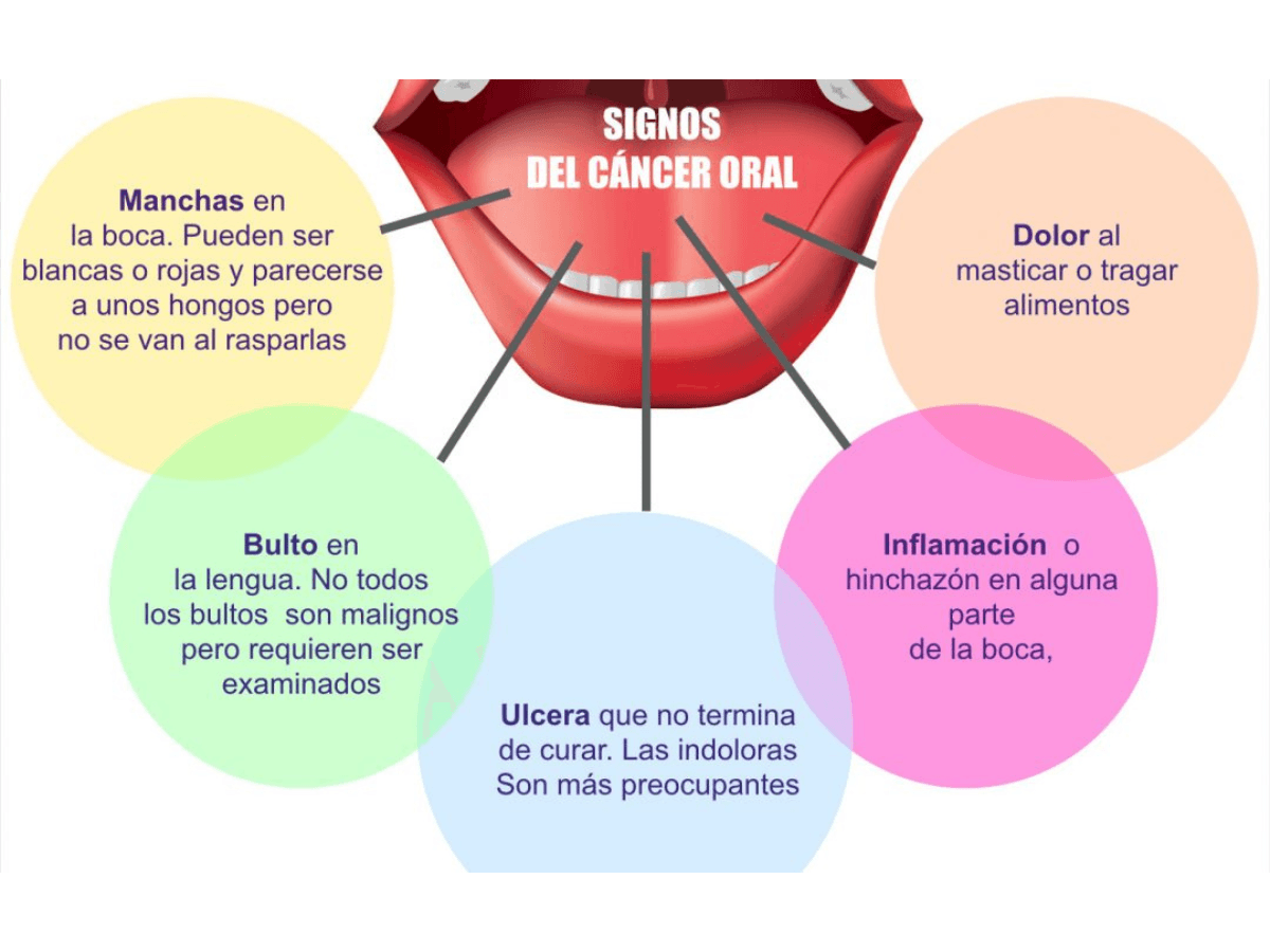 Síntomas cáncer oral