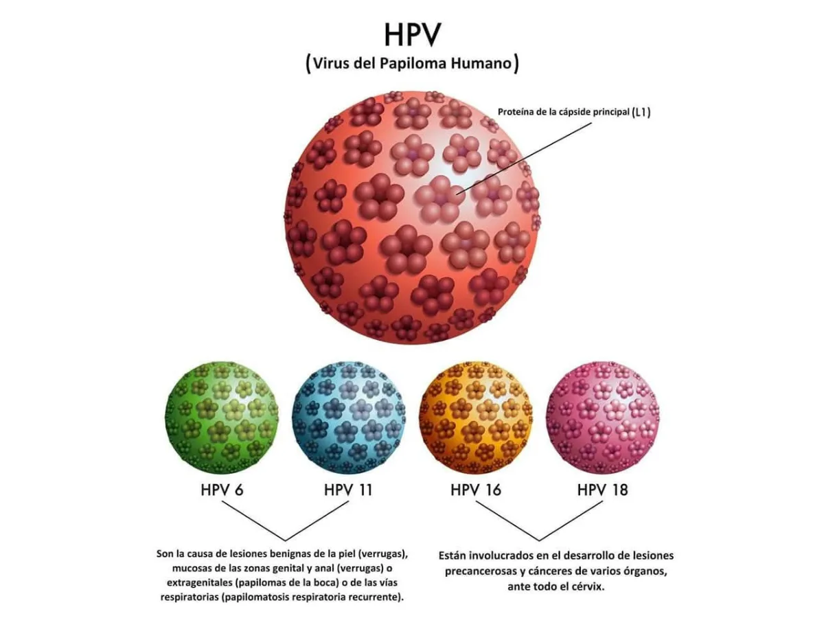 Tipos virus VPH